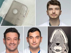 Лекари спасиха мъж с рядко и опасно усложнение от рибена кост в Пловдив