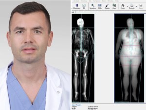 В Пловдив въведоха най-точния метод за анализ на телесния състав чрез ново изследване